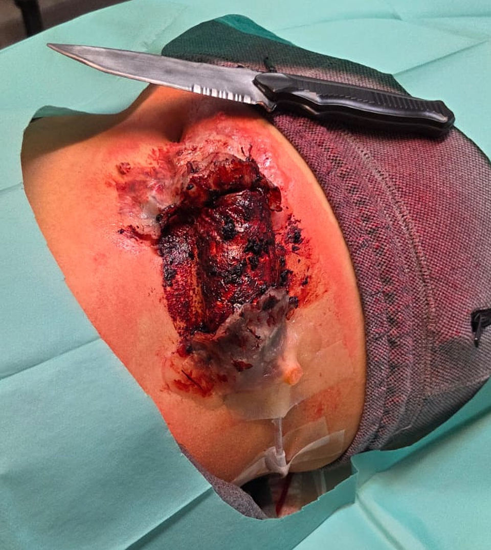 Blutiger Dienstabend